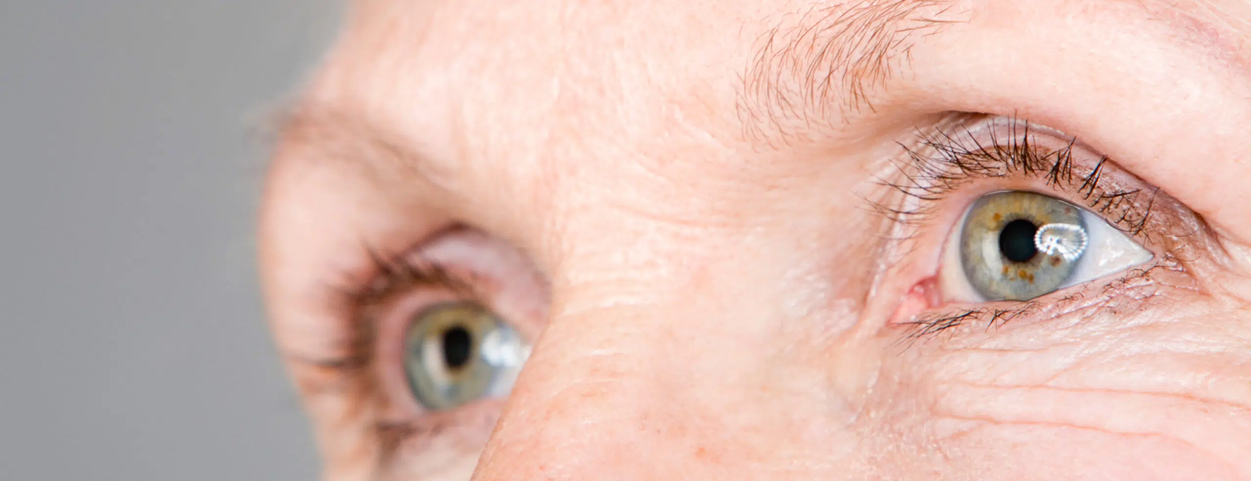 Combien coûte une blépharoplastie ?