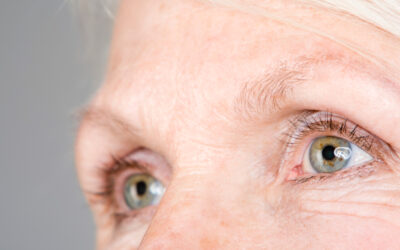 Blépharoplastie | Dr Renaud Duché | Avignon