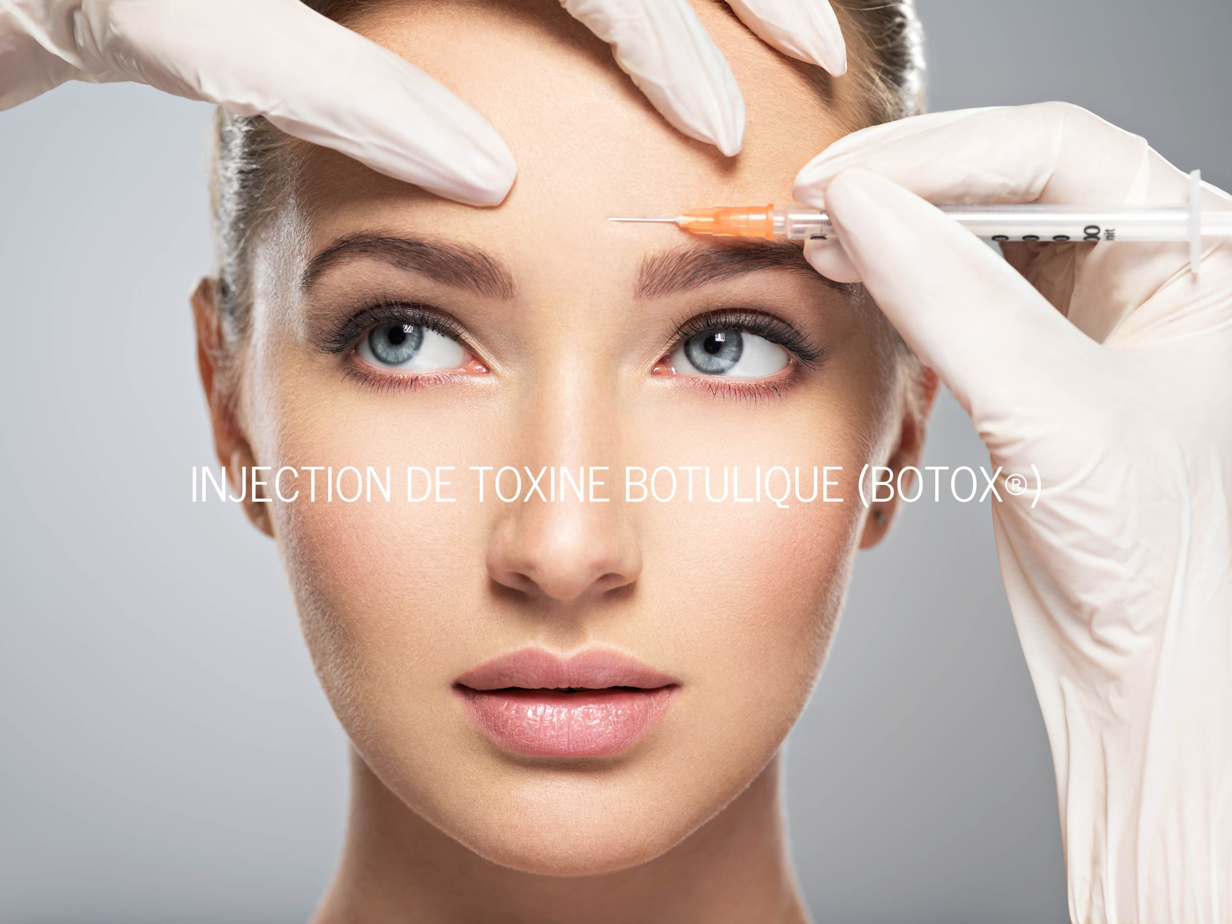 Injection de toxine botulique - Botox