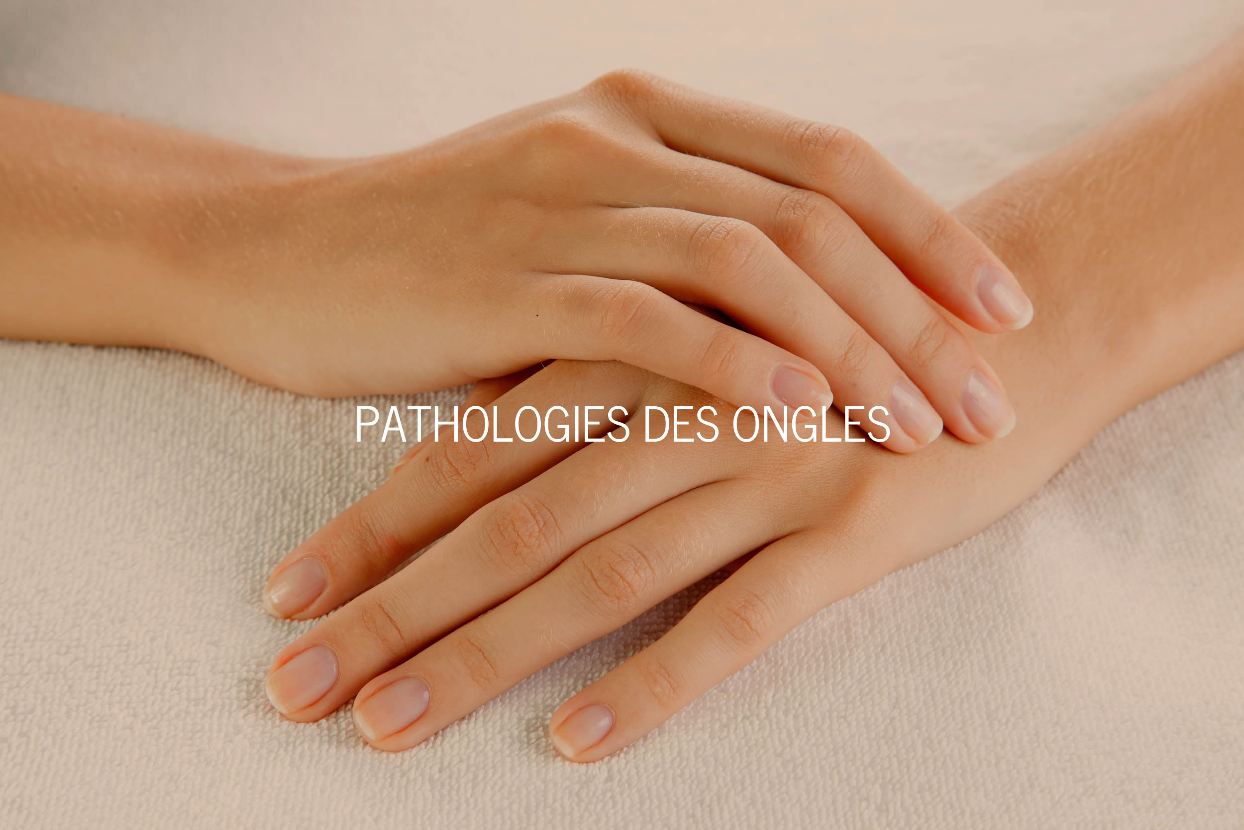 Pathologie des Ongles